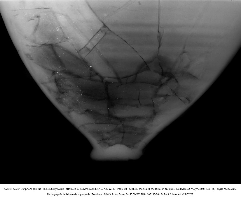Radiographie du bas de la panse ©C2RMF/ Elsa Lambert
