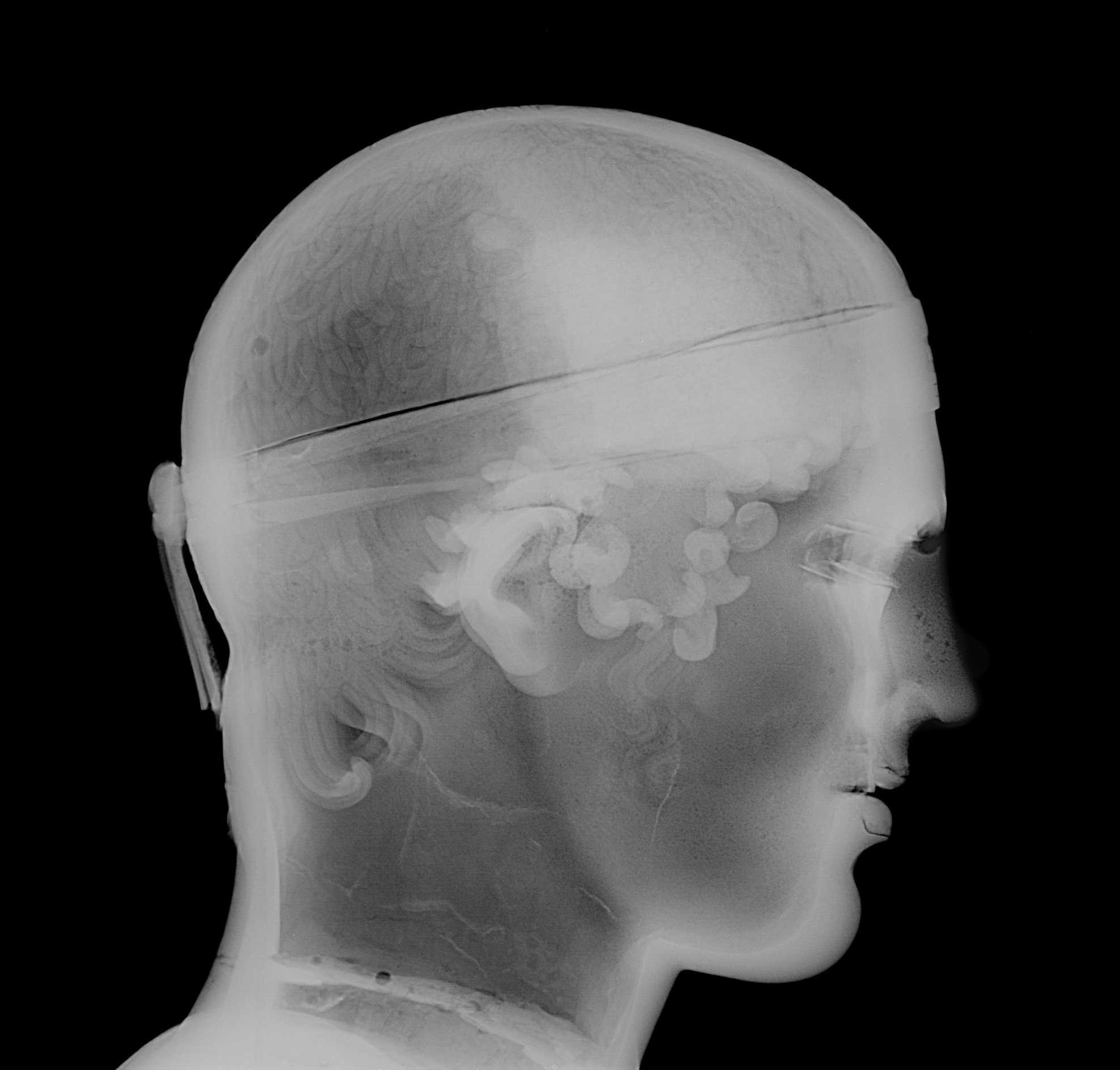 Radiographie de profil du visage de l’Aurige de Delphes ©C2RMF/ E.Lambert