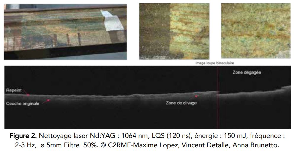 Nettoyage laser Nd:YAG : 1064 nm, LQS (120 ns), énergie : 150 mJ, fréquence : 2-3 Hz, ø 5mm Filtre 50%. © C2RMF-Maxime Lopez, Vincent Detalle, Anna Brunetto.