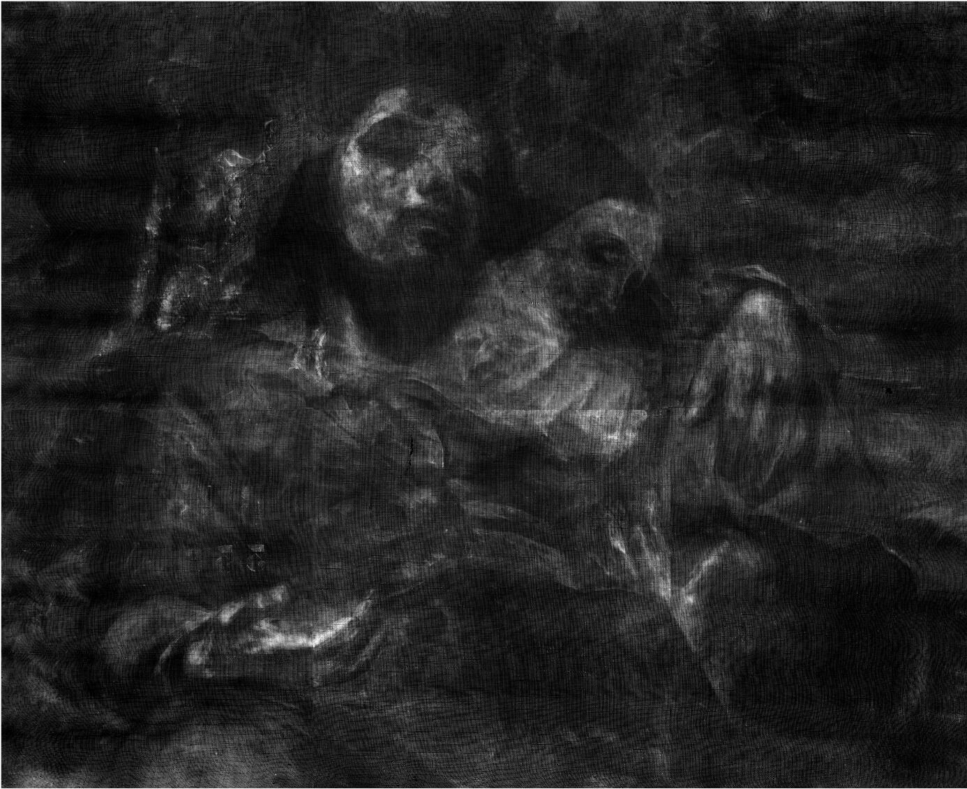 Radiographie de l'Homme blessé