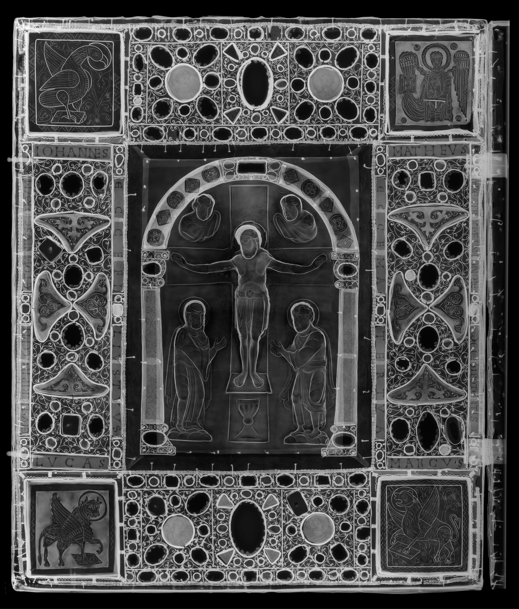 Radiographie de la face de la boite