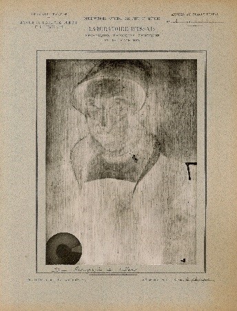 Arch. nat., 20190251/9. Portrait de femme tenant des gants, radiographie (1927)