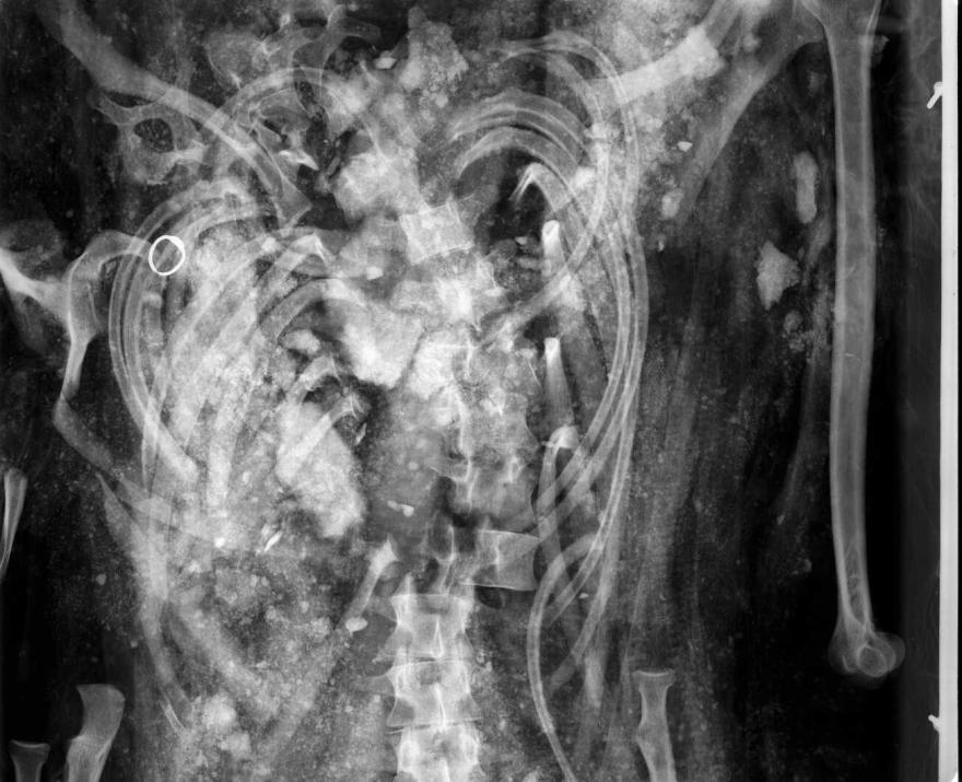 Media Name: radiographie, sur place au musée : mise en évidence de l'absence de connexion anatomique au niveau du thorax et de la présence d'une bague.
